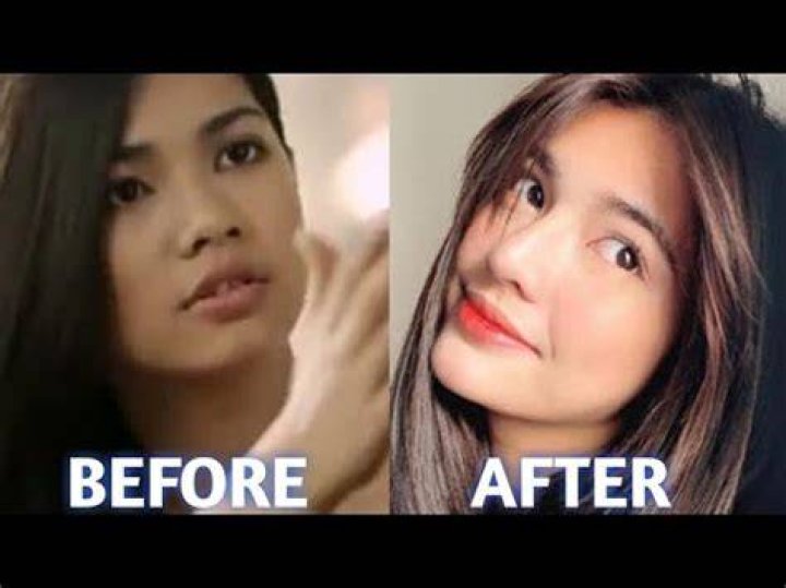Before Surgery Jane de Leon Face & Darna Costume Unreal Transformation Will Surprise You
