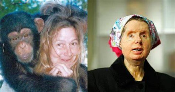 Charla Nash Face Reveal After Getting Attacked By Chimpanzee- Before Surgery Photos And More
