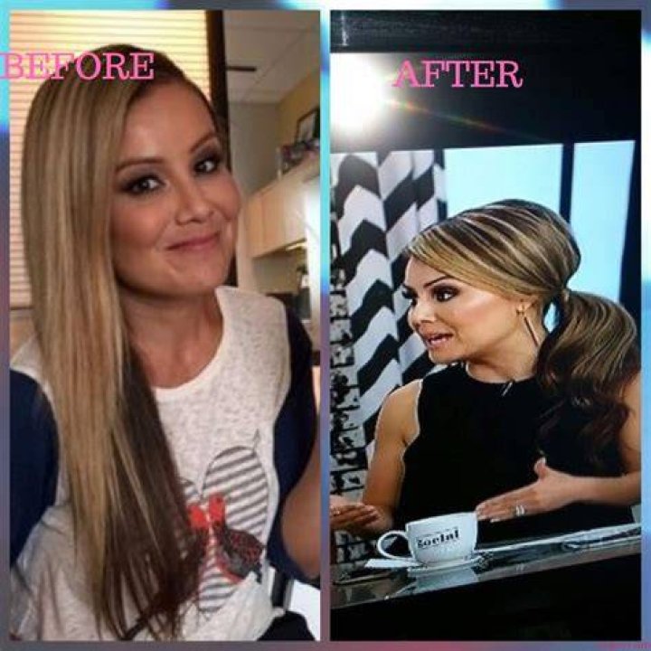 Did Melissa Grelo Undergo Plastic Surgery To Look Thin Or Does She Have An Illness? Weight Loss Explained