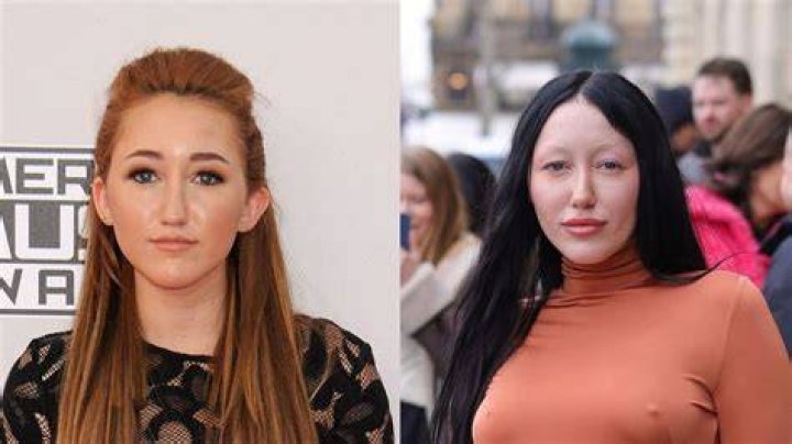 Fact Check: Is Noah Cyrus Asian? Before And After Photos -Everything On Her Mom And More