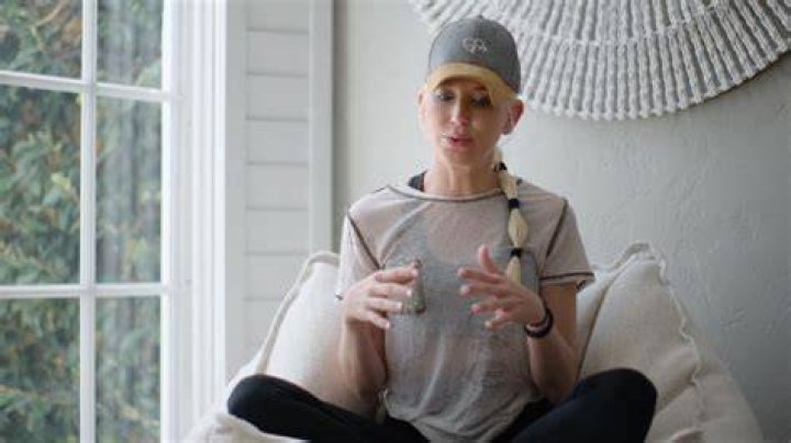 Galey Alix Illness And Mental Health: Why Does She Always Wear Hat?