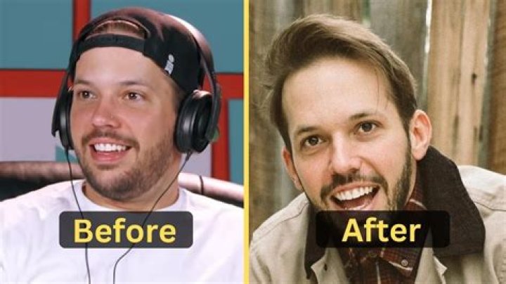 Heath Hussar Weight Loss Journey, How Did He Lose Weight?