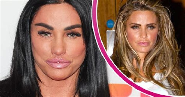 Katie Price Before Plastic Surgery: Did She Get Her Lips And Nose Done?