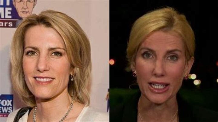 Laura Ingraham Lips: Did Laura Ingraham Get Her Lips Done? Plastic Surgery Before And After Photos