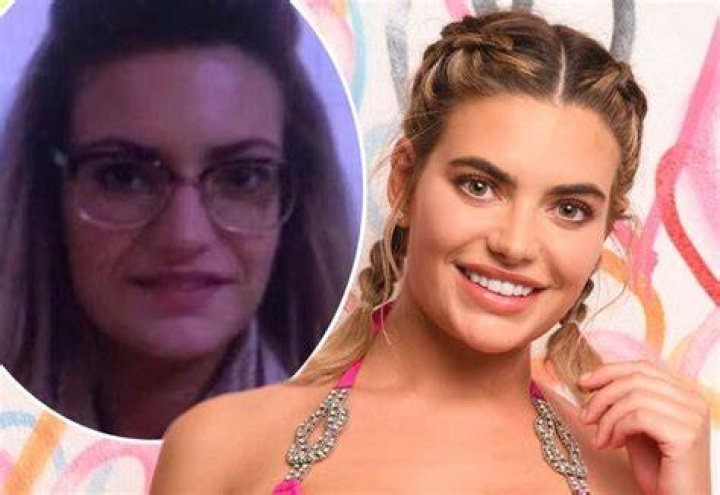 
Megan Barton Hanson Before Plastic Surgery Photos- Love Island Star Details To Know 