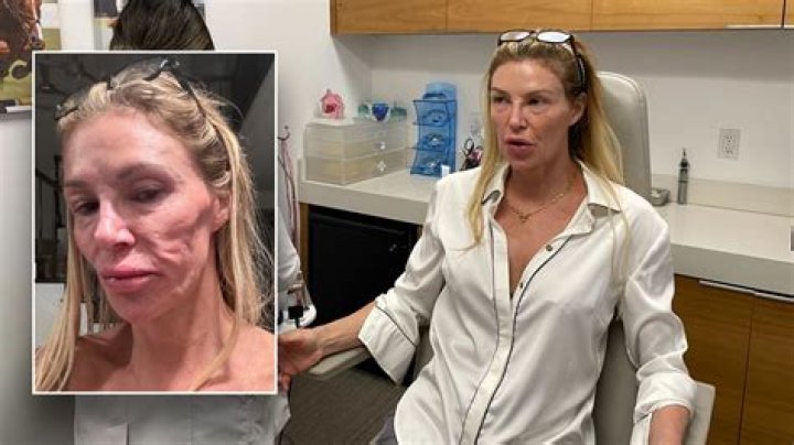 
RHOBH Star Brandi Glanville Stated That Tamara Became Different Person Around Vicki Gunvalson 