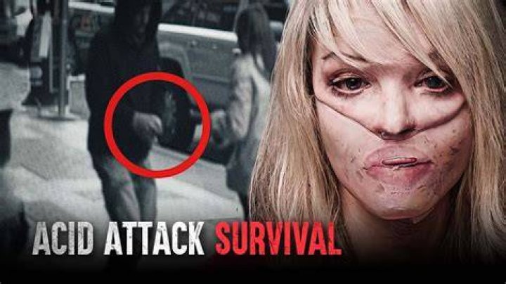 
The Truth About Katie Piper, Her Husband and What Led to Her Acid Attack 