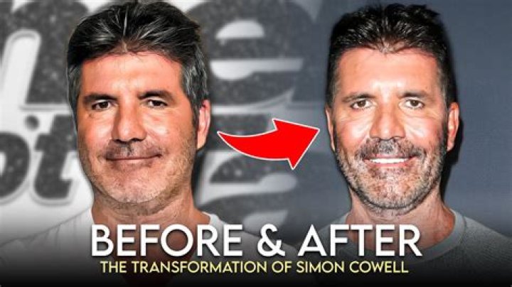 What Happened To Simon Cowell’s Face? Fans Concerned With His Disappearing Eyes